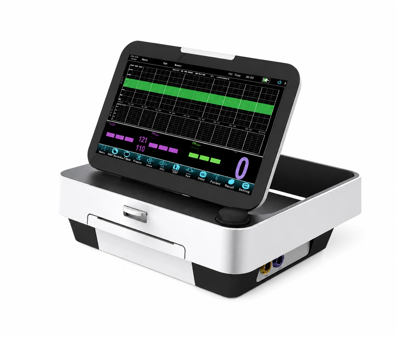 CTG Monitor